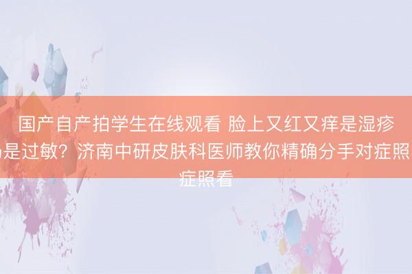 国产自产拍学生在线观看 脸上又红又痒是湿疹仍是过敏？济南中研皮肤科医师教你精确分手对症照看
